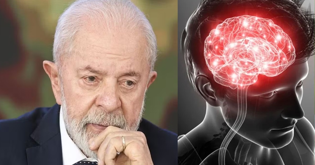 Saiba os sintomas e como prevenir a hemorragia intracraniana, uma das doenÃ§as mais letais que acometeu Lula